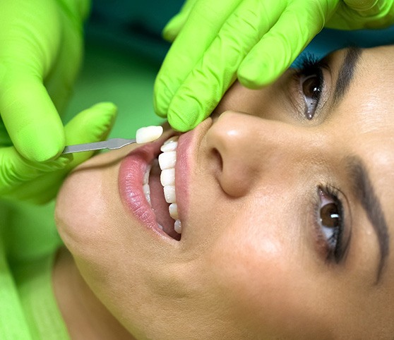 Woman getting veneers