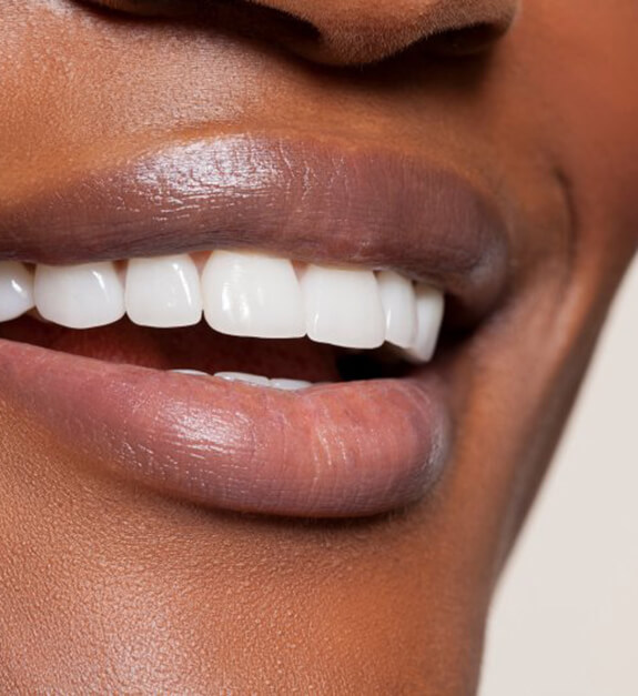 a person with bright teeth and smiling